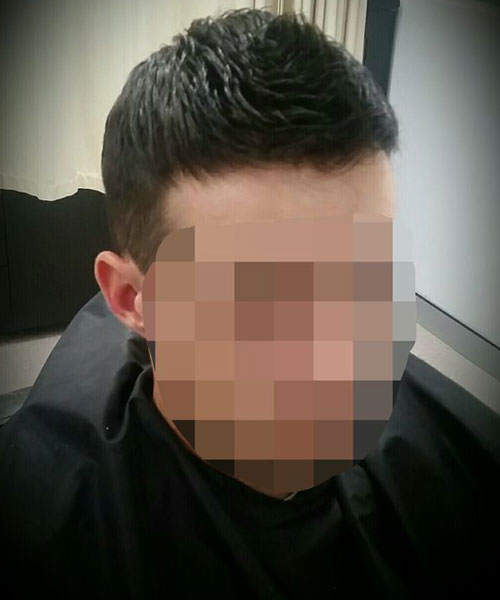 hair clinic service in sydney for men