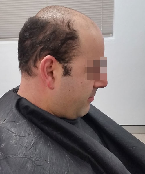 sydney hair removal clinic