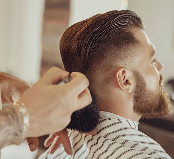 male-baldness male-baldness